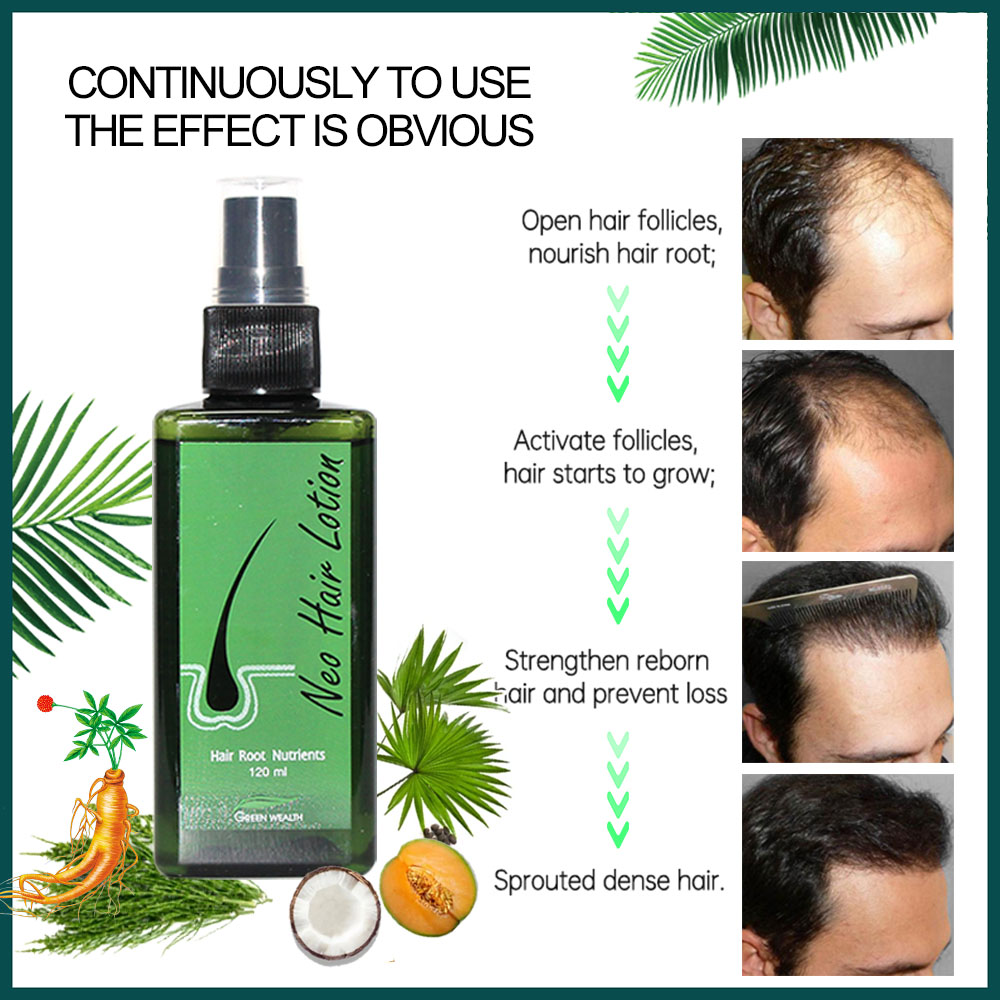 4 قطع لوشن نيو للشعر 120 مل، م - مراجعة Biotin Hair Growth وسعره