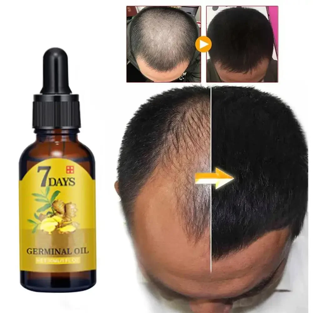 نمو الشعر الزنجبيل سريع النمو  - مراجعة Biotin Hair Growth وسعره