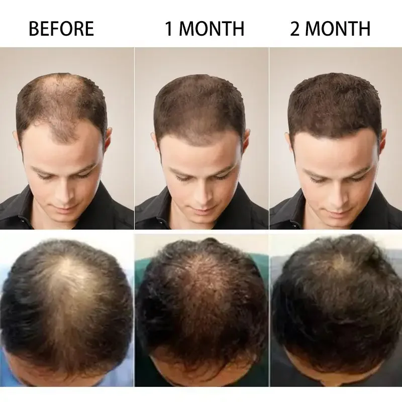 نمو الشعر الزنجبيل سريع النمو  - مراجعة Biotin Hair Growth وسعره